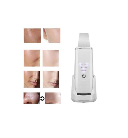 Dispozitiv cu ultrasunete skin scrubber pentru curatare faciala, EMS, cu 4 functii, incarcare wireless, alb